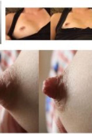 Aroused female nipples