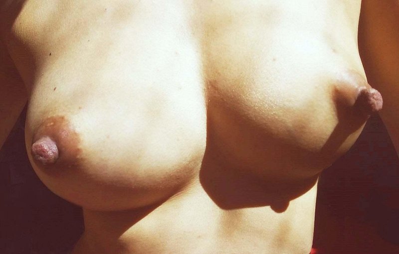 For breast augmentation