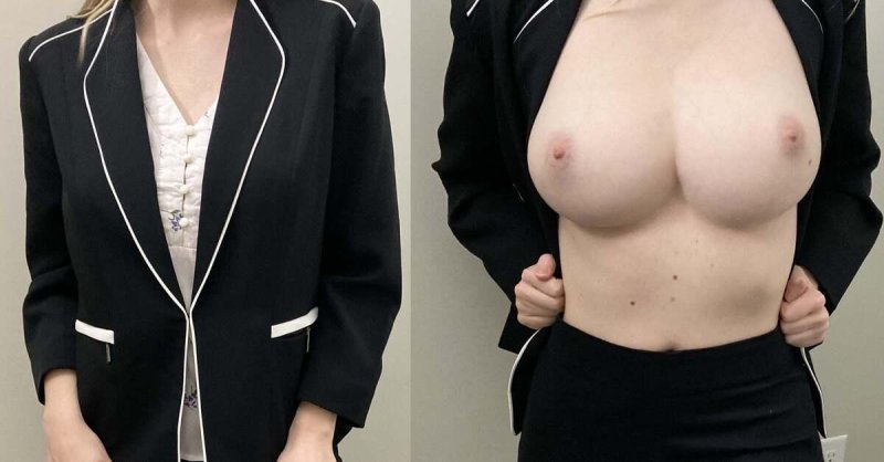 Female jackets