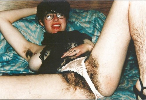 Hairy woman