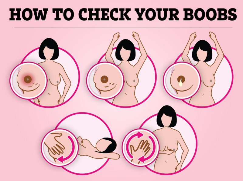 For breast augmentation