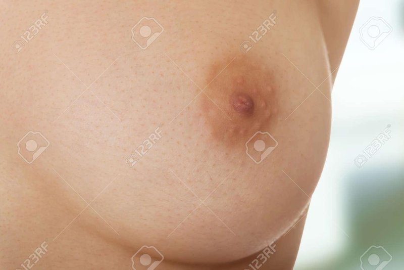 Female breasts in the usual state