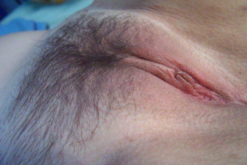 Hair on the vagina