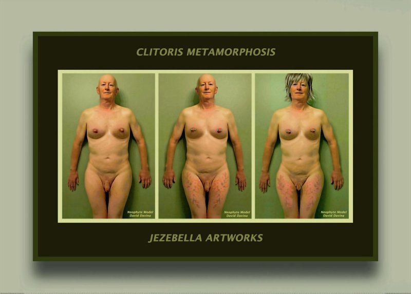 Woman with one breast
