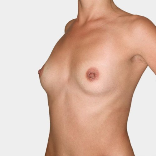 Naked breasts