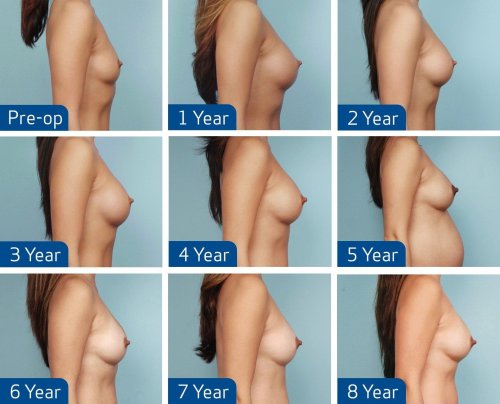Naked breasts of all sizes
