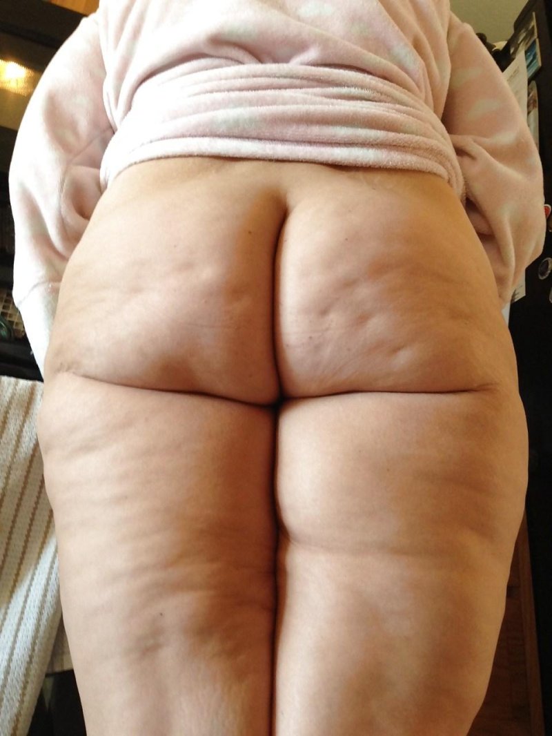 Big cellulite buttocks