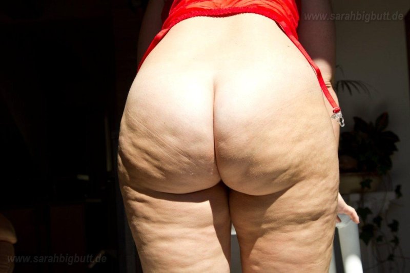 Beautiful cellulite