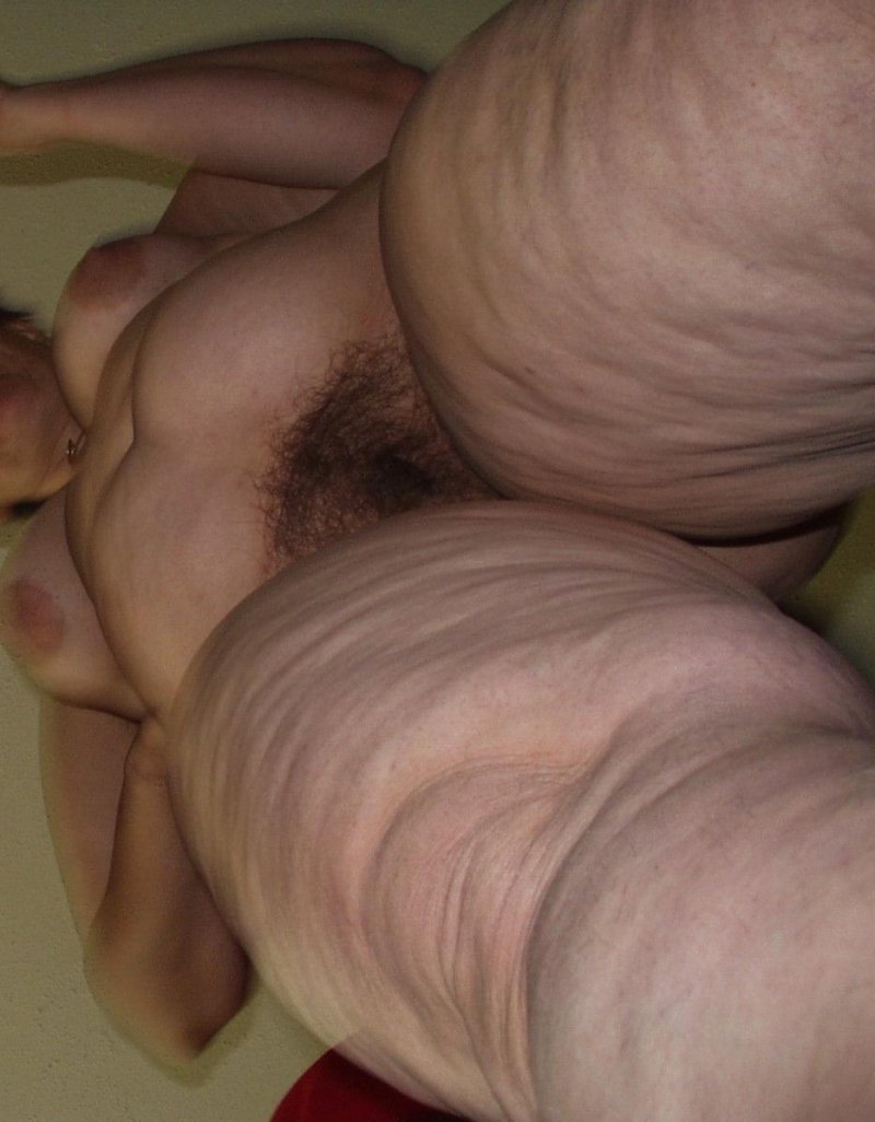 Hairy old woman cellulite
