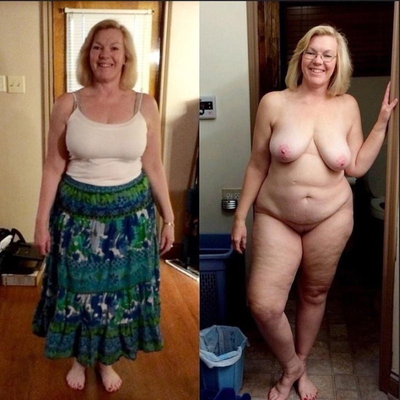 Before and after losing weight