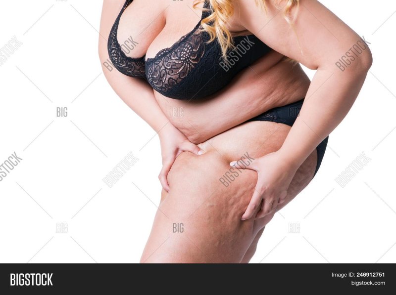 A woman with thick stomach
