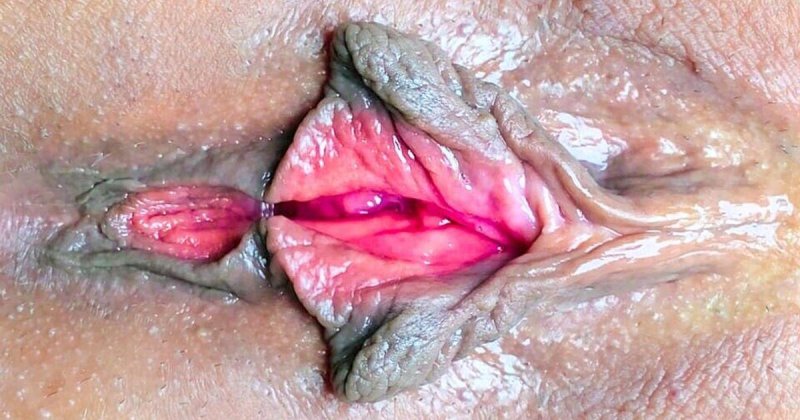 Ulcer on the vagina