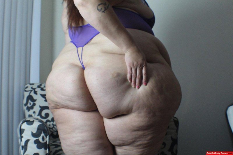 Burnt ass