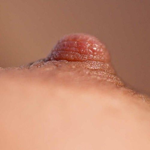 Papilloma on nipples