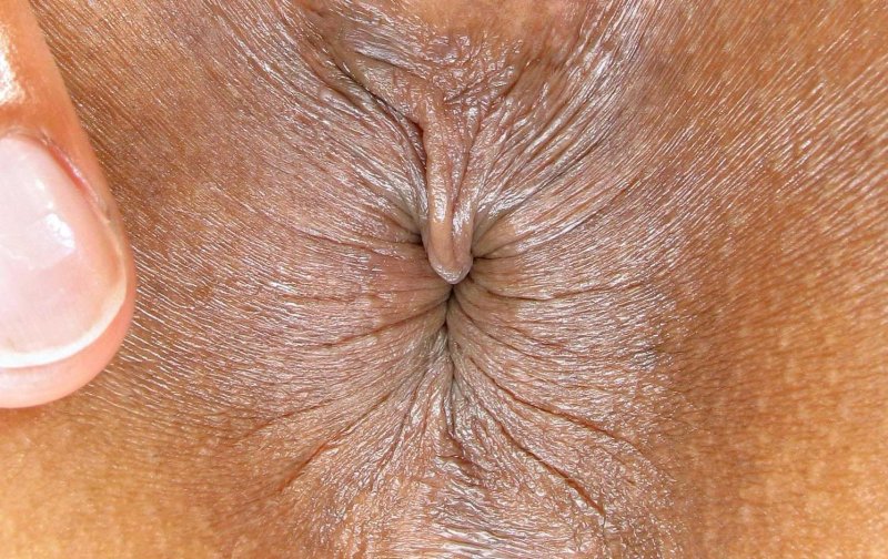 Anus women