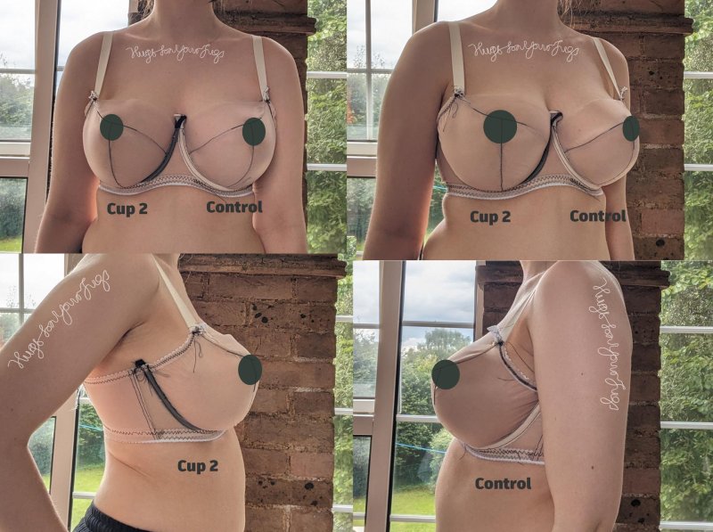 Breast cup size