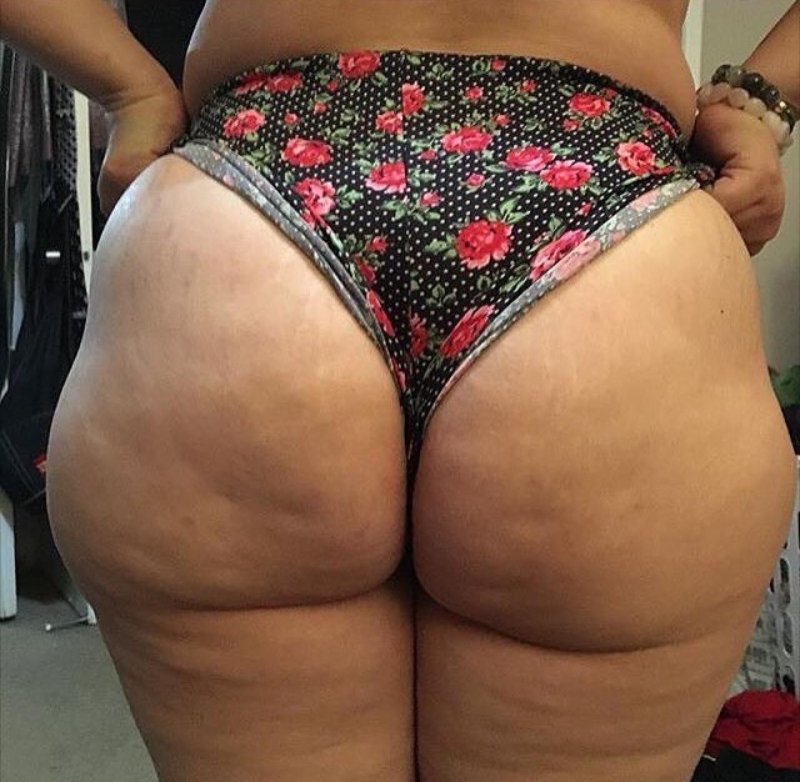 Thick cellulite women