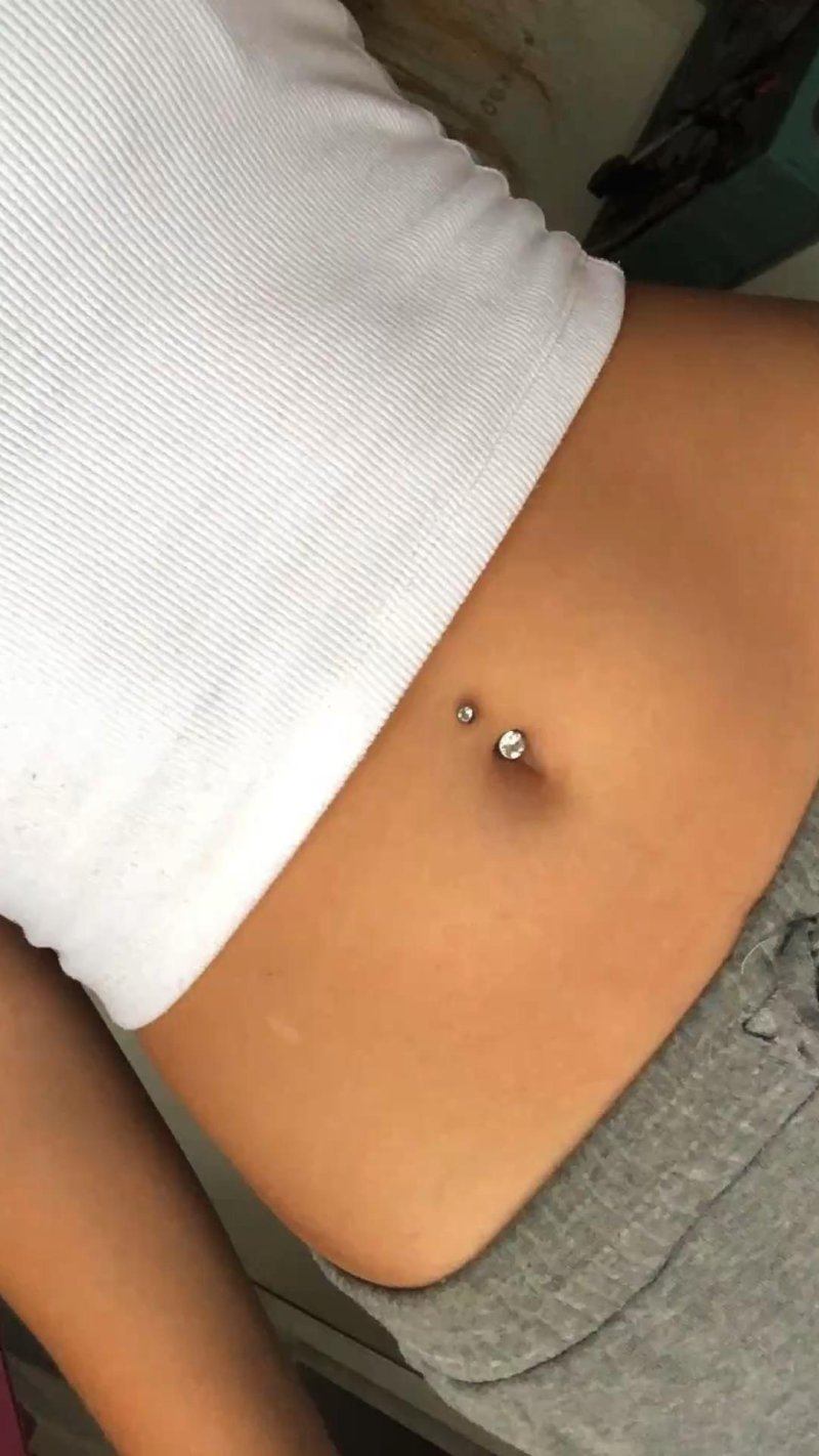 The navel is a puncture