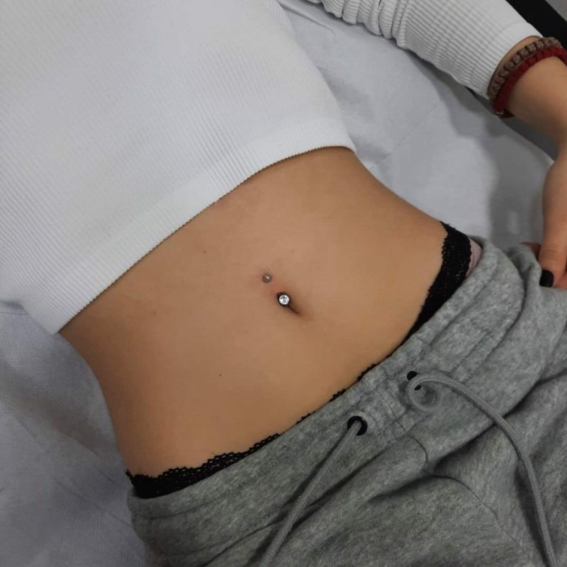 The puncture of abdomen