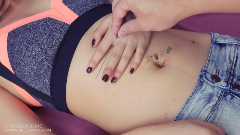 Navel needle