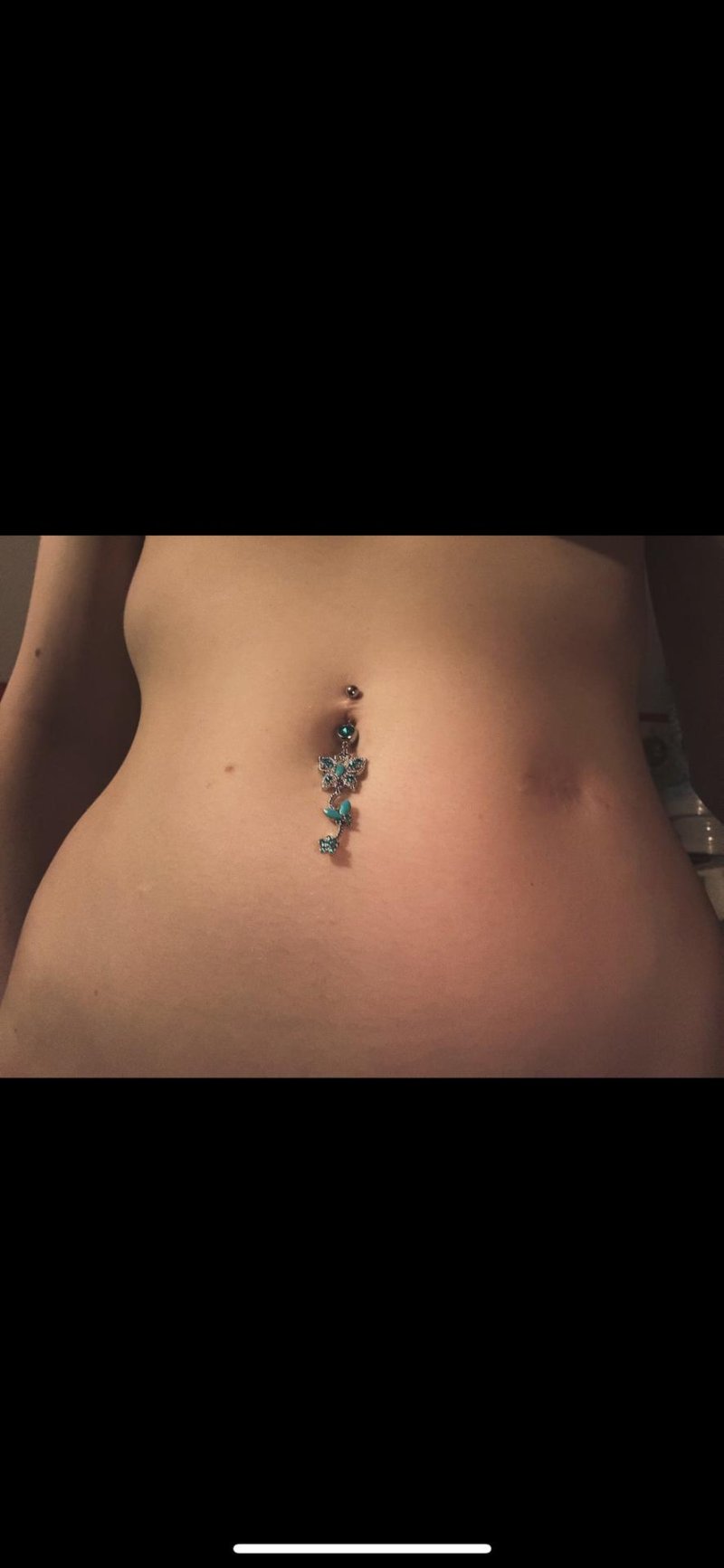 Puncture in the navel
