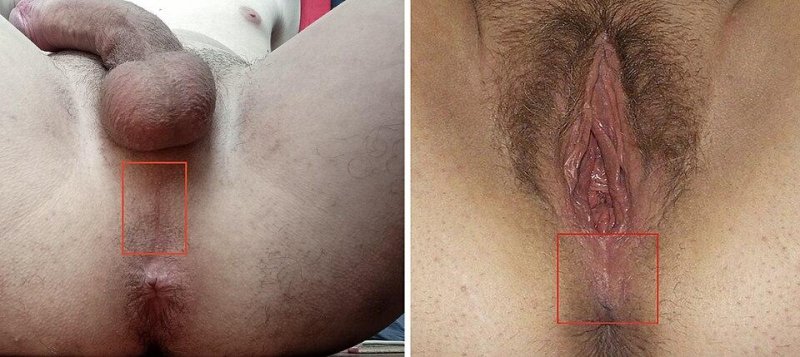 Crotch in men