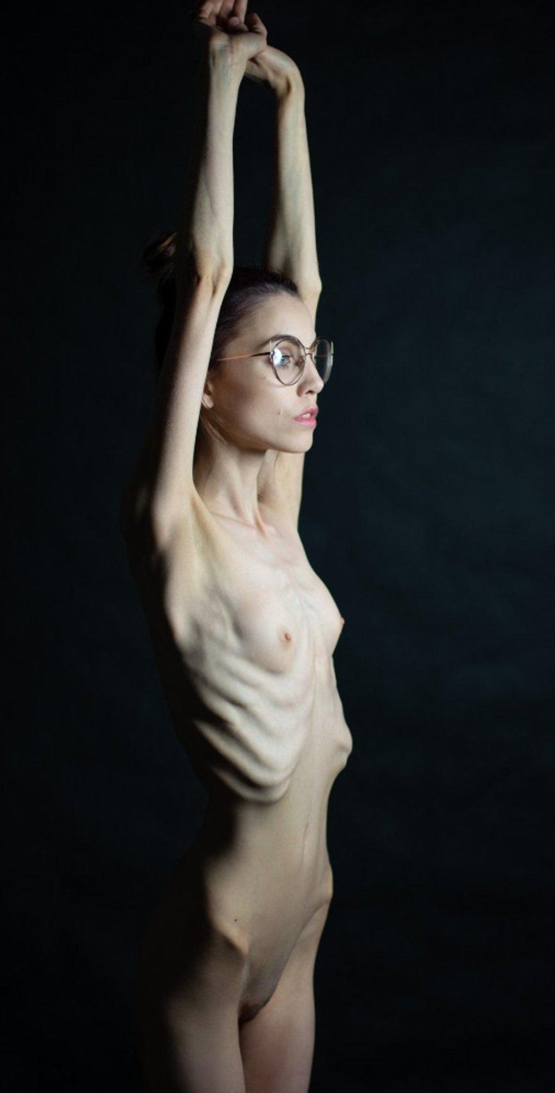 Naked anorexic women
