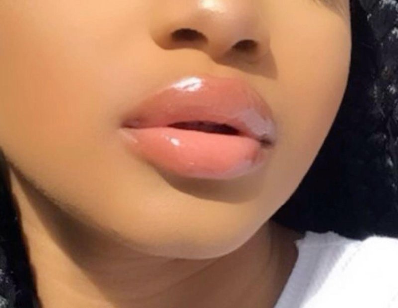 Dream lips
