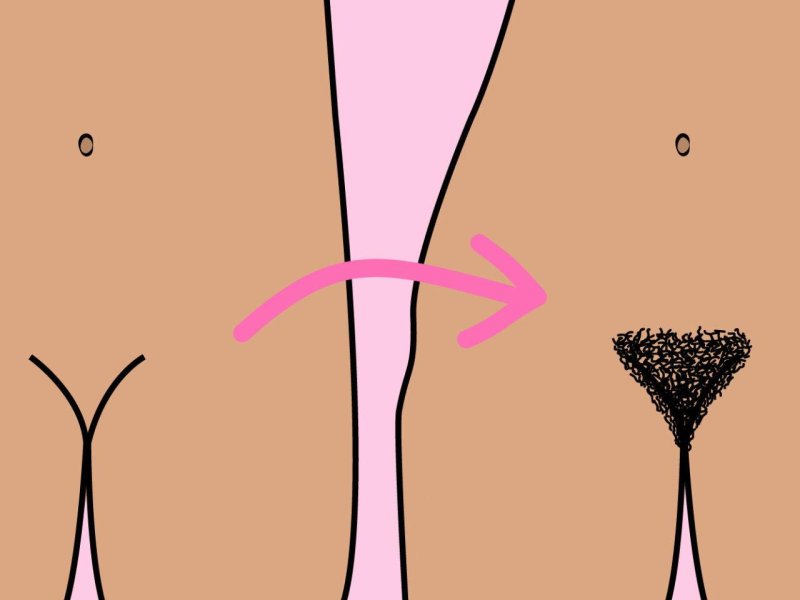Bikini Zone