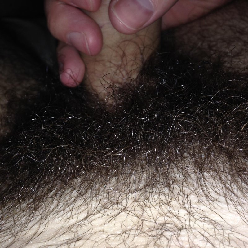 The longest hair on pubis