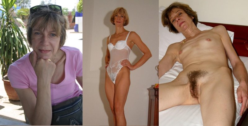 Adult woman with sagging breasts