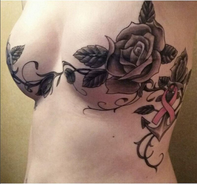 Batches on the female chest