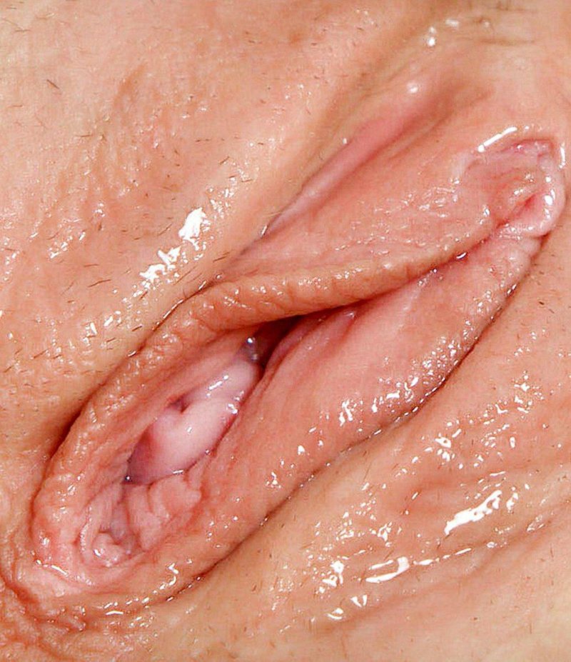 Vaginal plastic