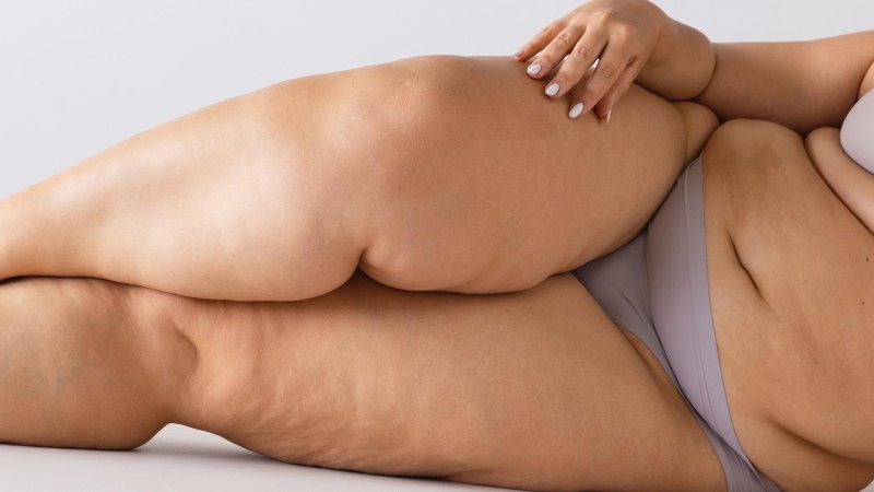 Girls with cellulite