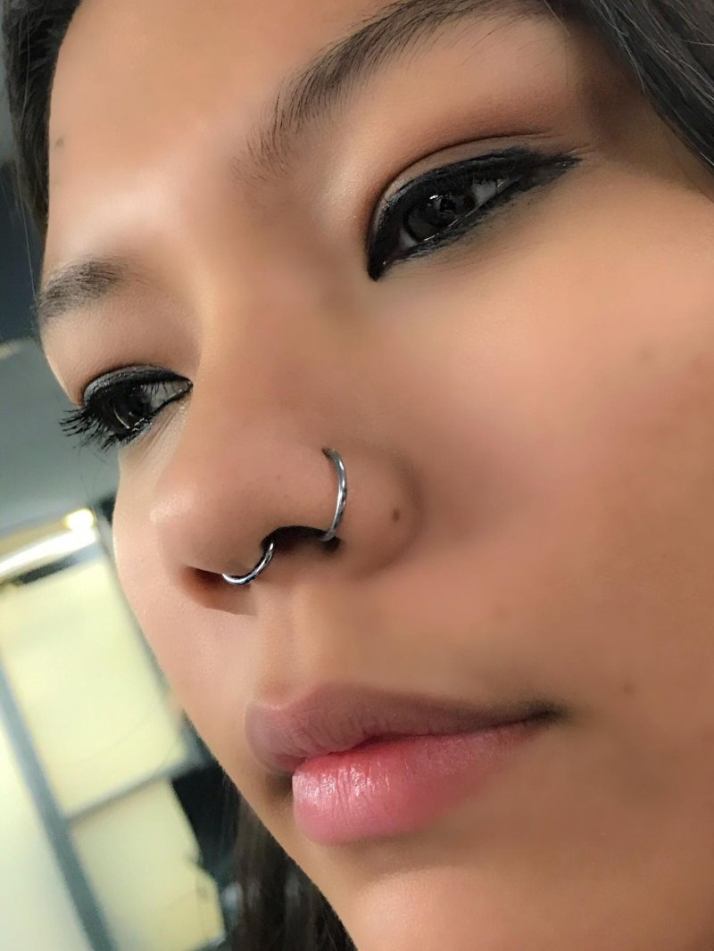 Septum Puncture