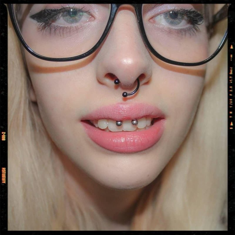 Puncture smile and septum