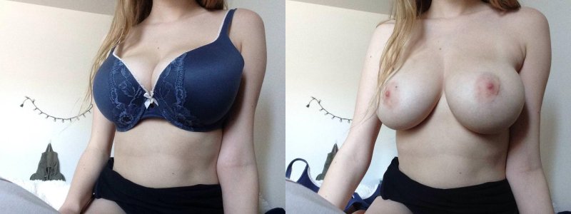 Brand Breast