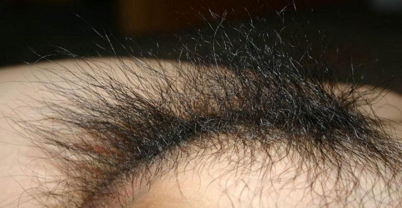 Hair on the groin