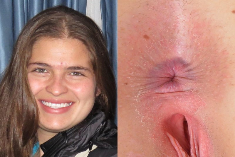 Anus and face